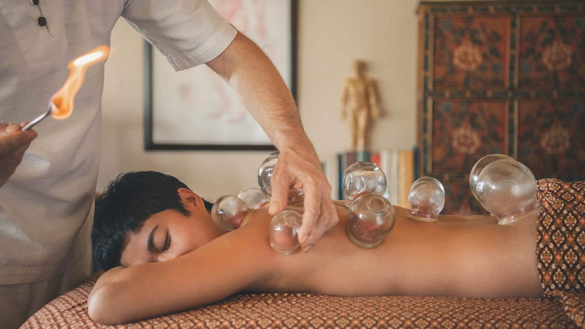 Cupping Traditional Chinese Theraphy